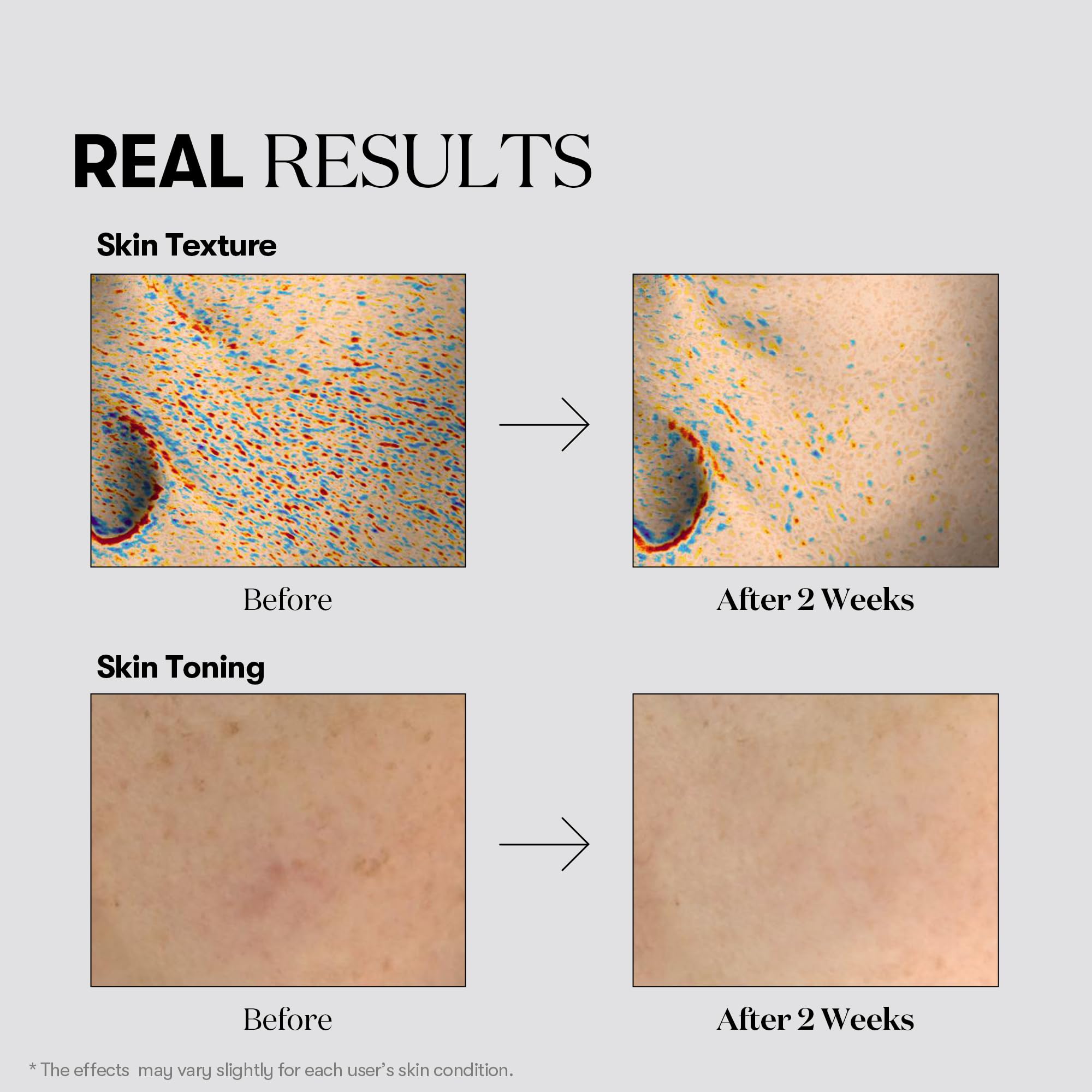 Amazon.com : VT COSMETICS TX Toning Daily Mask 30 Sheets